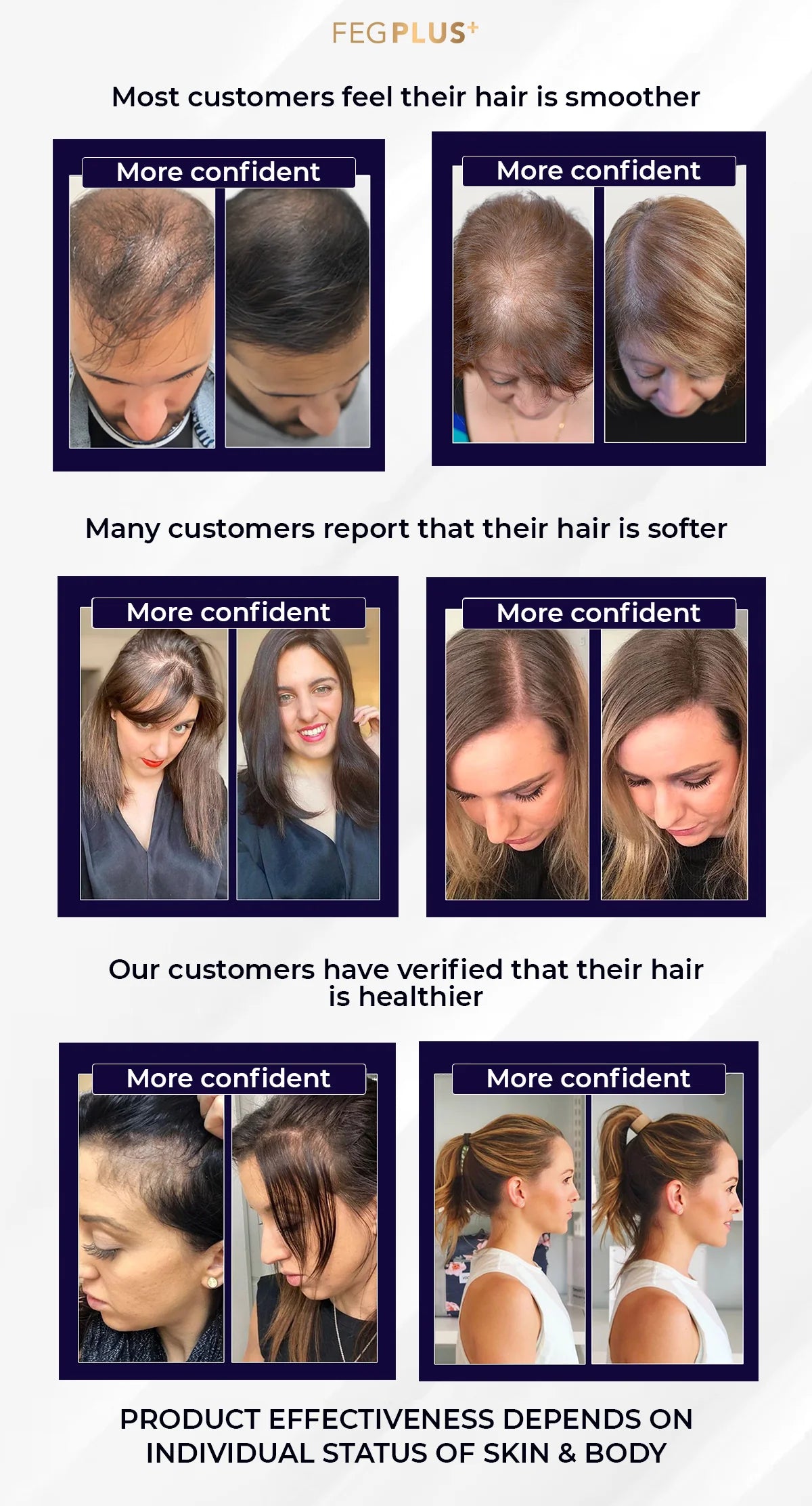 FEG-Hair Growth Spray